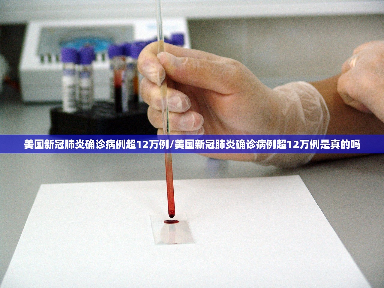 31省新增本土确诊2例:31省新增本土确诊最新数据