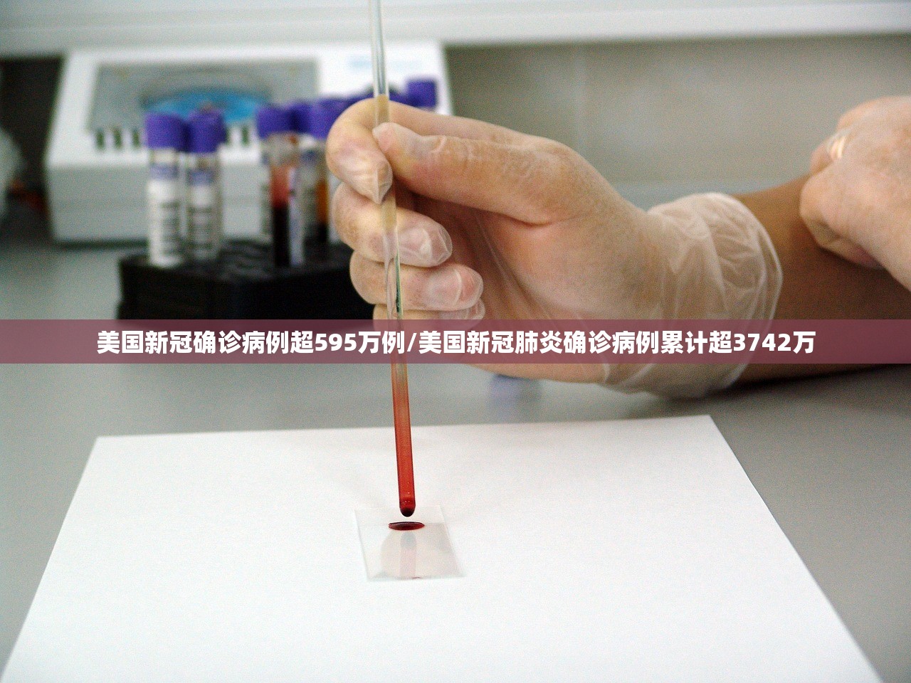 美国新冠确诊病例超595万例/美国新冠肺炎确诊病例累计超3742万